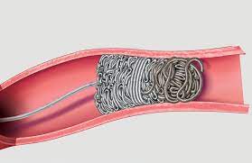 DeviceMD - POD®
