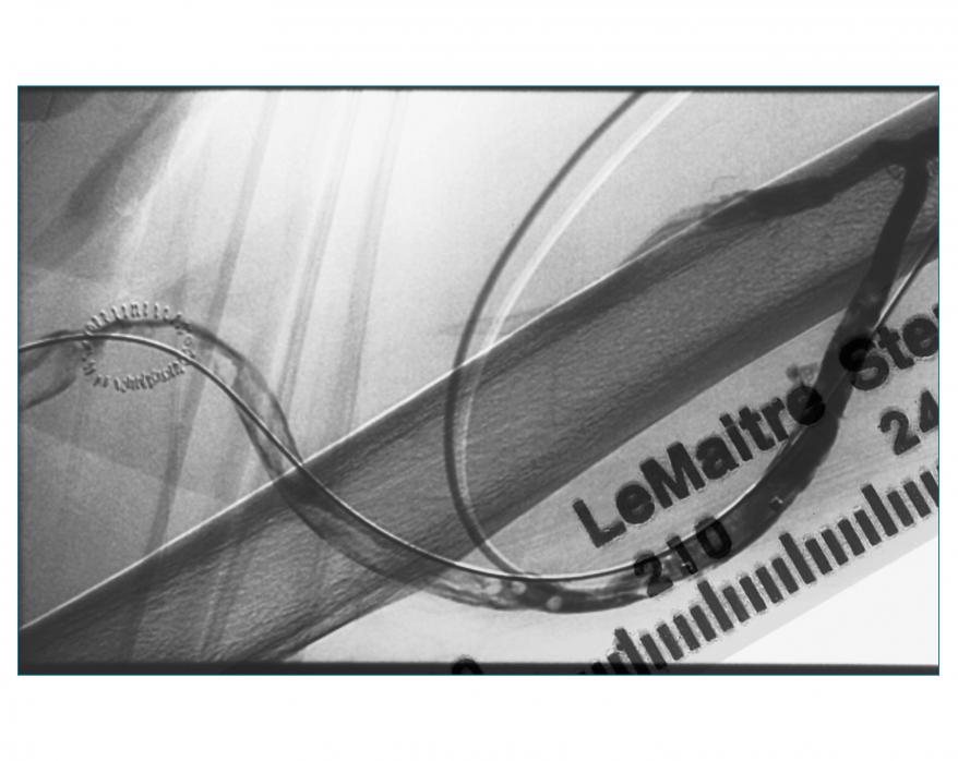 DeviceMD - VascuTape® Radiopaque Tape